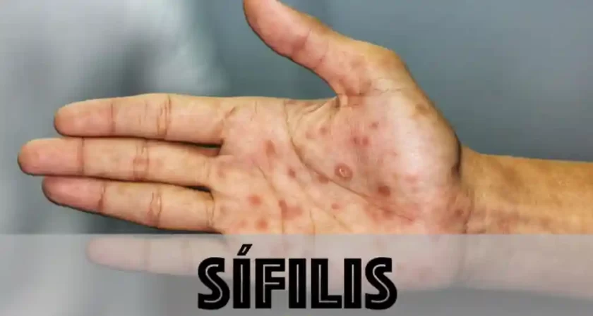 Preocupante alerta en Santa Fe: Aumento sostenido de casos y reinfecciones de Sífilis Preocupante alerta en Santa Fe: Aumento sostenido de casos y reinfecciones de Sífilis